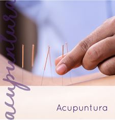 Acupuntura